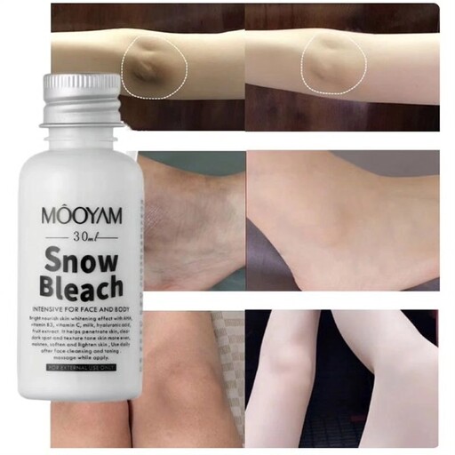 کرم سفید کننده 
حجم 30 میل 
مناسب برای انواع پوست
رفع تیرگی و روشن کننده بدن و صورت