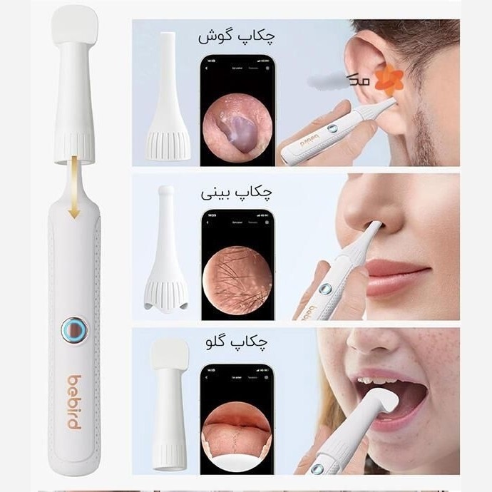 گوش پاک کن Bebird مدل R37R شیائومی قیمت عالی
