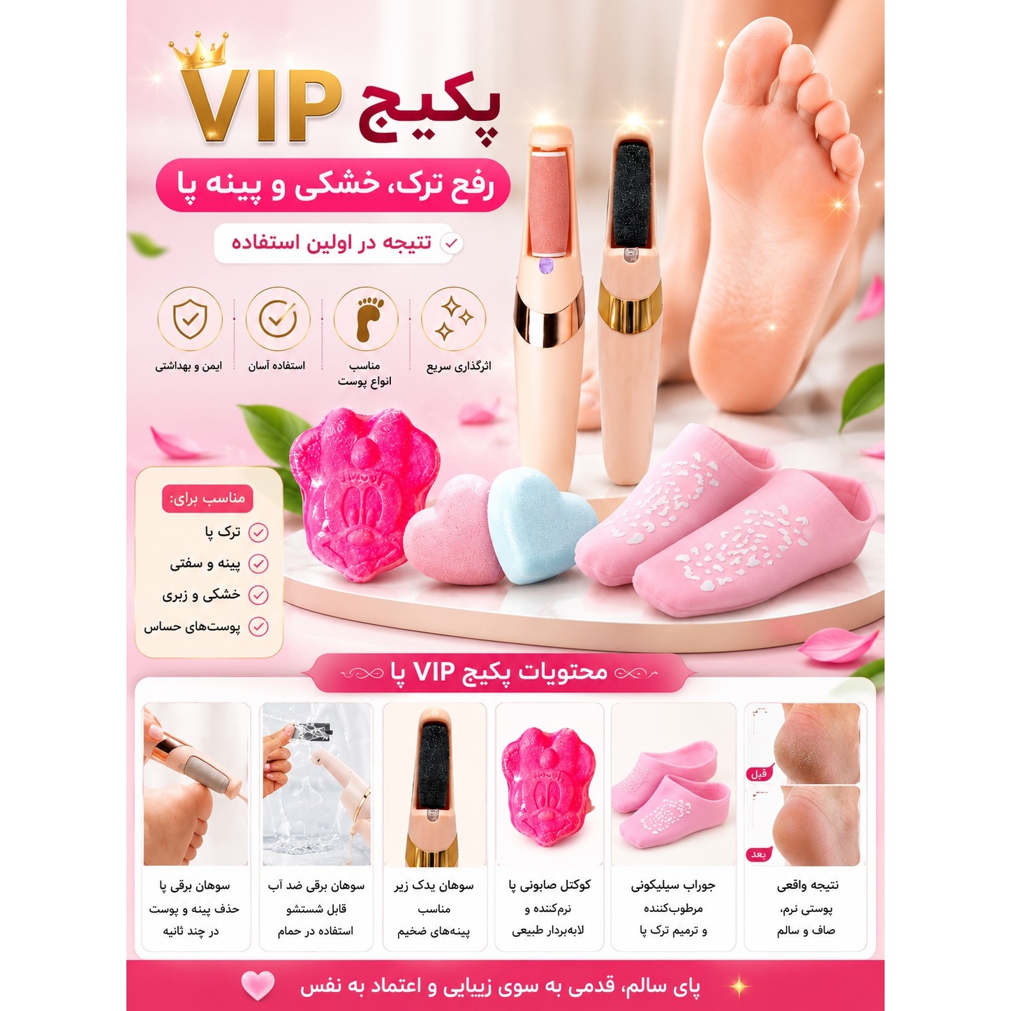 پکیج VIP رفع ترک، خشکی و پینه پا سوهان برقی، جوراب سیلیکونی و کوکتل پدیکور