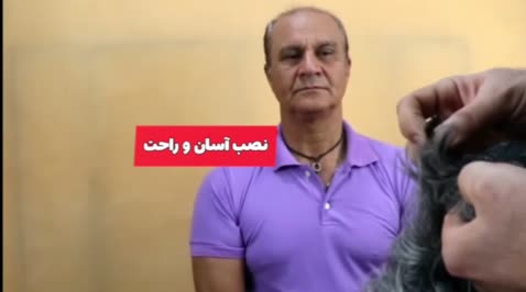 کلاه گیس مشکی خرمایی مردانه زنانه مصنوعی مشهد وارداتی