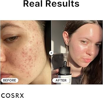 سرم نیاسینامید 15 درصد کوزارکس Cosrx ضدلک و ضد جوش حجم 20 میل