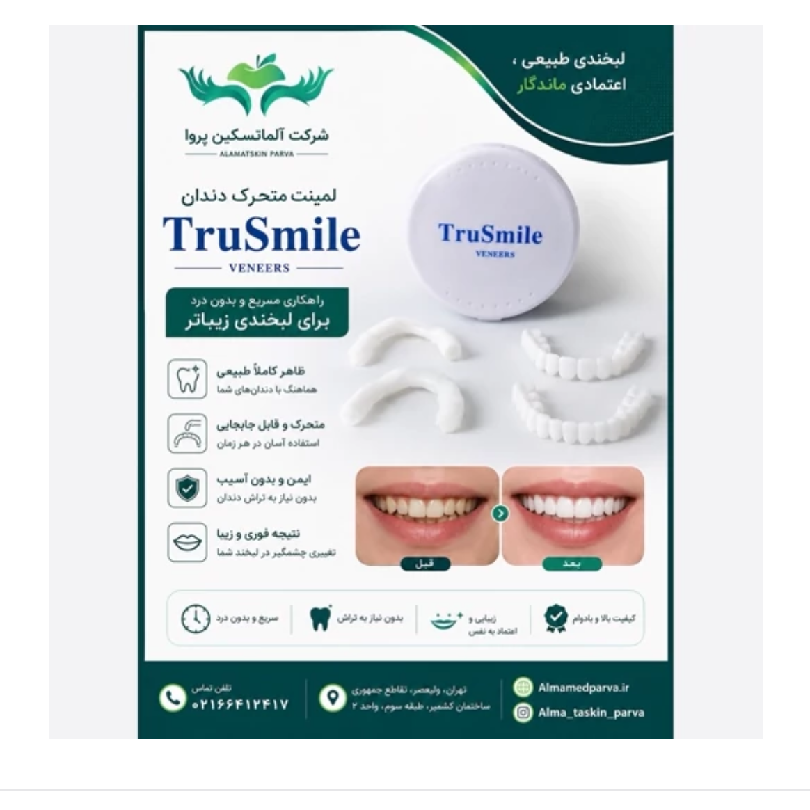 لمینت متحرک دندان ترو اسمایل عمده 15 عددی
