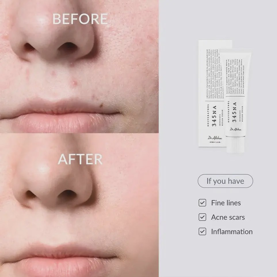 کرم ترمیمکننده دکتر آلتیا 345 Relief Cream ترمیم و تسکین پوست حساس اورجینال