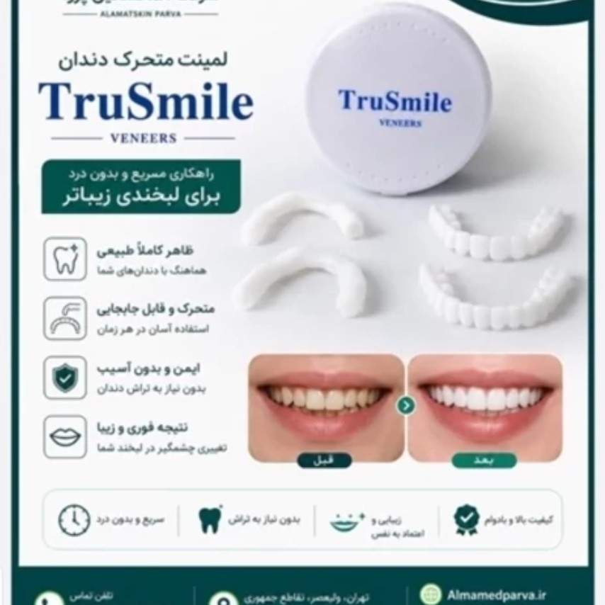 لمینت ترواسمایل متحرک دو فک