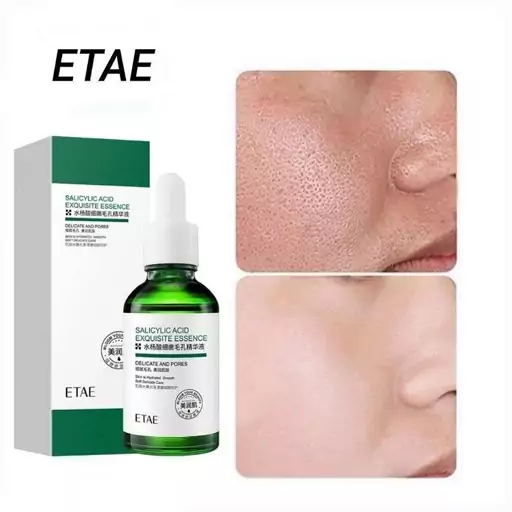 سرم ضدجوش سالیسیلیک اسید ETAE حجم 30ML