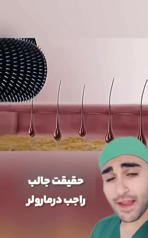 درمارولر یاماساژور غلتکی افزایش کلاژن و میکرو صورت(قیمت مناسب،عرضه مستقیم)