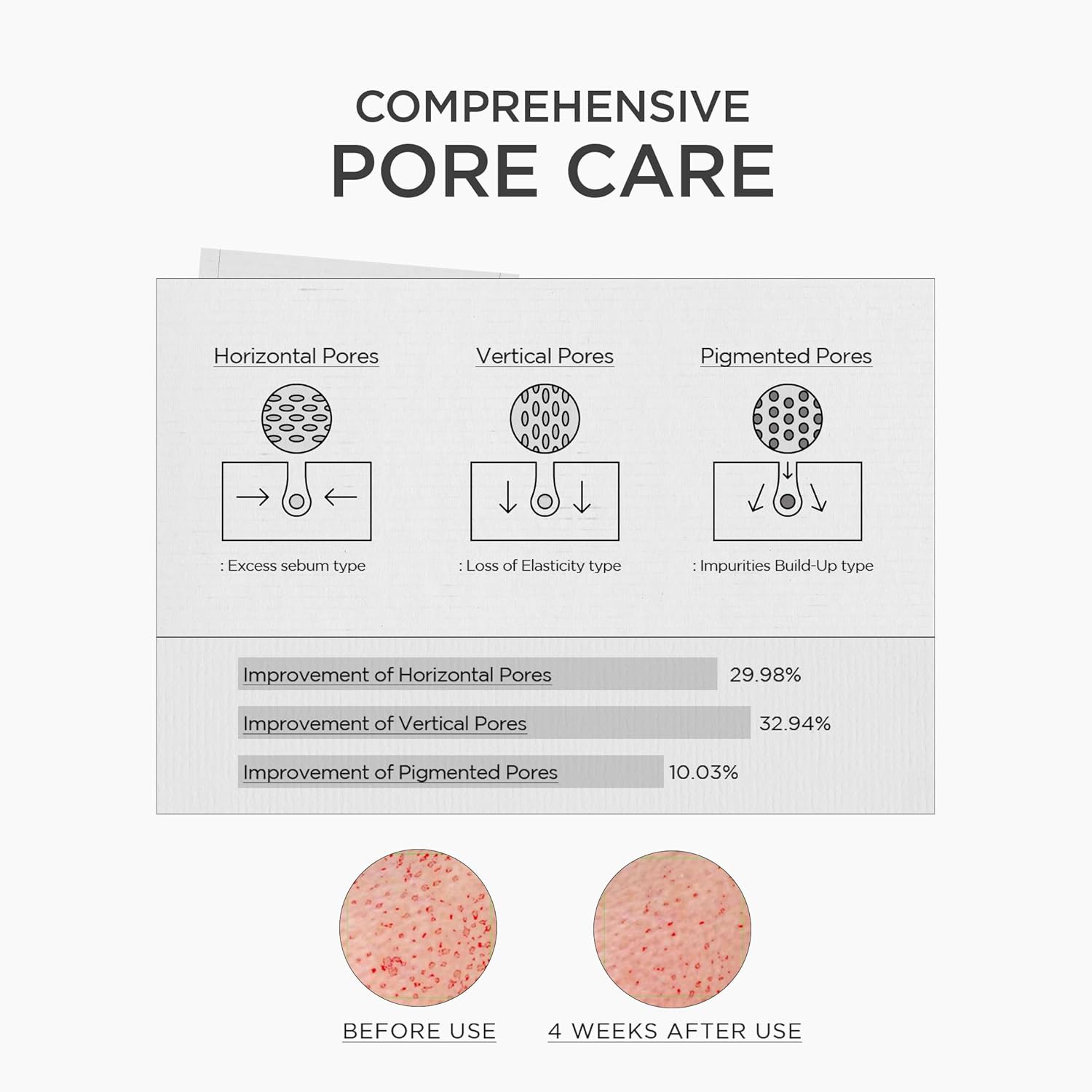 آمپول نیاسینامید 10 اسکین1004 SKIN1004 Madagascar Centella Niacinamide 10 Boosting Shot Ampoule 9ml