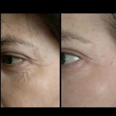 بیوممتیک سرم تیرگی دور چشم (اصل فرانسه)جدید