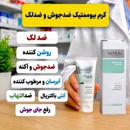 کرم ضدجوش و ضدلک بیوممتیک ایتالیایی(ضمانت اصل و ارسال فوری)جدید