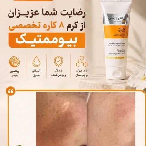 کرم بیوممتیک ضدلک و روشن کننده ایتالیایی(ضمانت اصالت)جدید