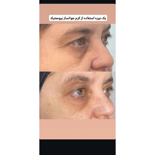 جوانساز 12 کاره بیوممتیک (جایگزین بوتاکس)اصل ارجینال جدید