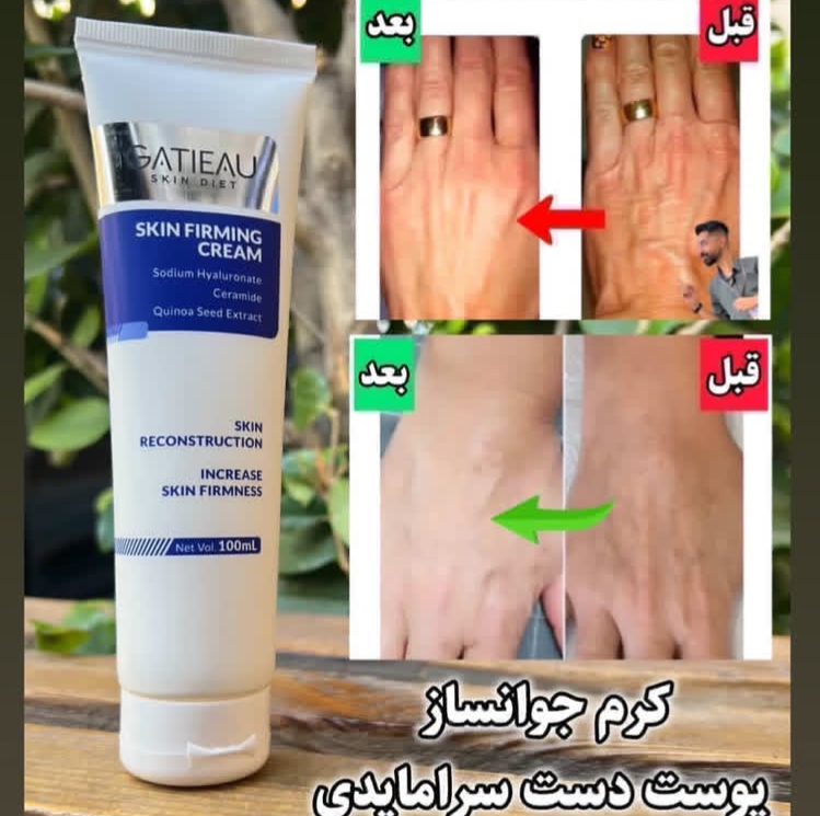کرم جوانساز دست سرامایدیجدید