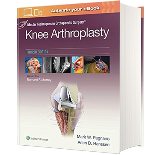 کتاب Master Techniques in Orthopedic Surgery Knee Arthroplasty اثر Mark W. Pagnano and Arien D.Hanssen انتشارات لیپین کا