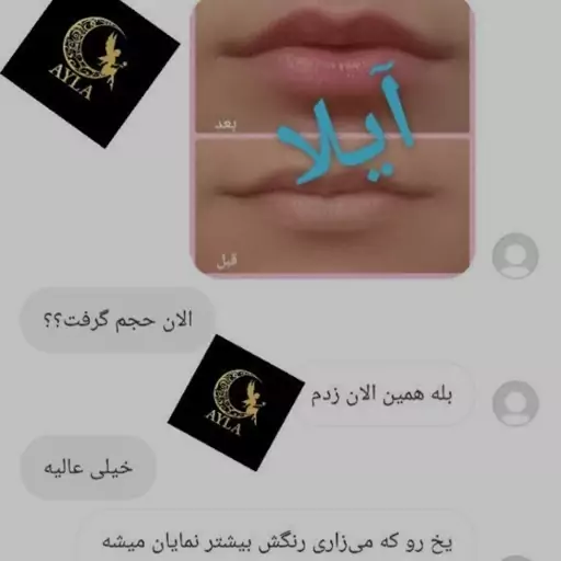 تونیک لب شاین دار آیلا 