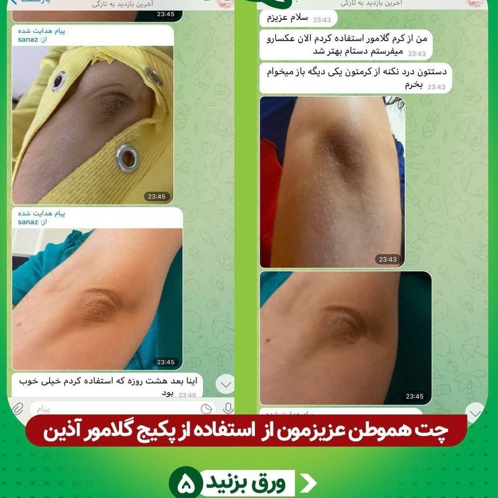 کرم و صابون روشن کننده بدن گلامور آذین 