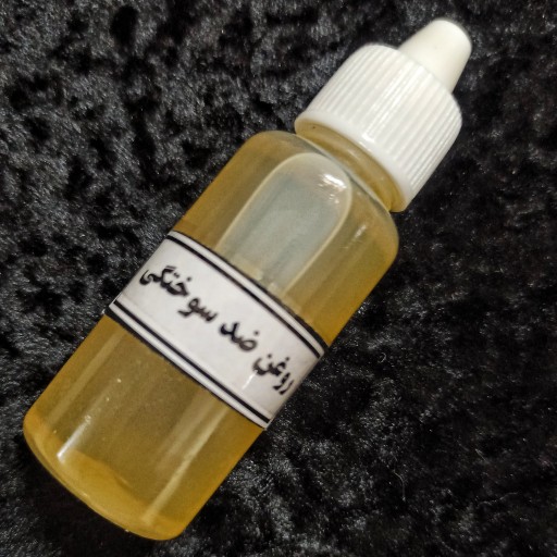 روغن ضدسوختگی 30 میل