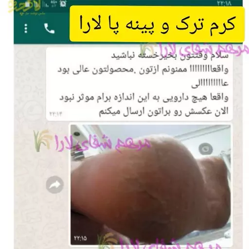 کرم ترک پا   و  پینه 