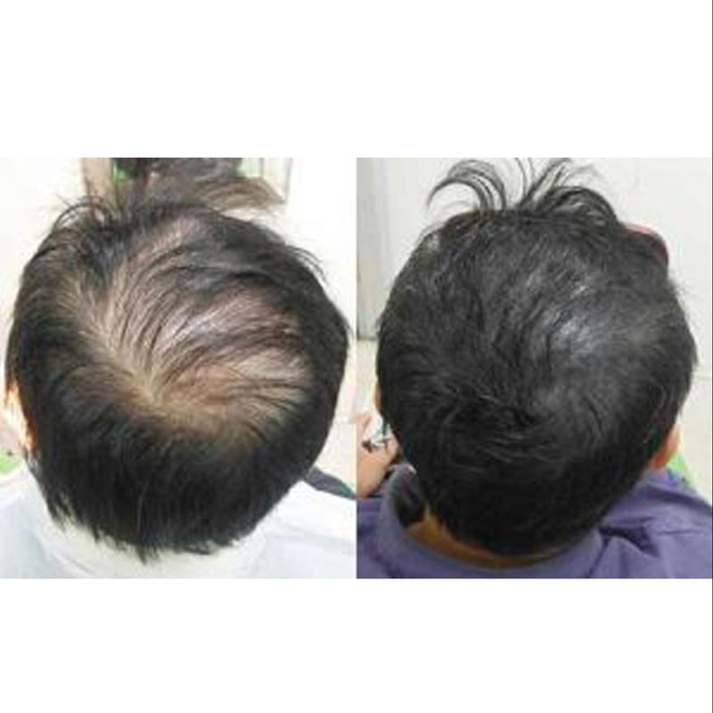 کوکتل ضد ریزش مو و تقویت کننده مو کلین بیوتی مدل ANTI HAIR LOSS