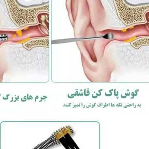 گوش پاک کن فنری 6 عددی