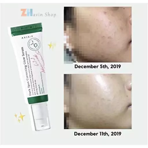 سرم مدل دارک اسپات Dark Spot  ضد لک و روشن کننده و از بین برنده جای جوش  