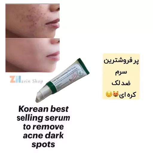 سرم مدل دارک اسپات Dark Spot  ضد لک و روشن کننده و از بین برنده جای جوش  