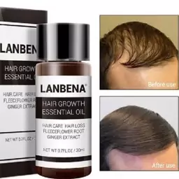 سرم رشد مو و تقویت ریشه مو لانبنا  LANBENA Hair Growth Essential Oil