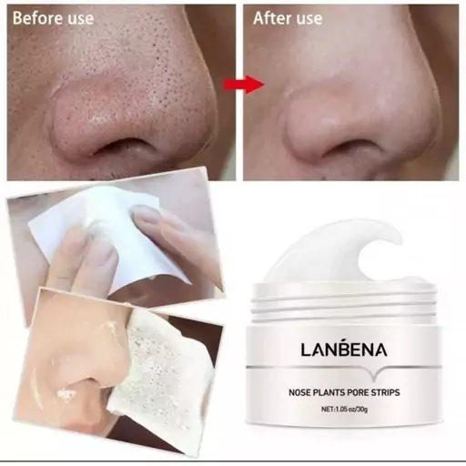 چسب بینی کاسه ای ضد جوش سرسیاه لانبنا Lanbena nose plant pore strips قبل از ثبت سفارش موجودی بگیرید 