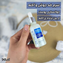 سرم ضدجوش و آکنه بیوآکوا