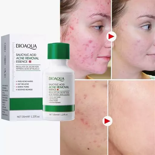 سرم ضد جوش بایو آکوا مدل salicylic acid حجم 35 میلی لیتر