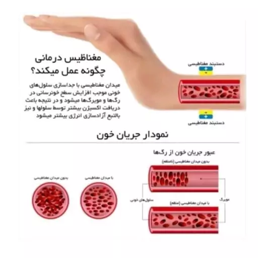 دستبند مغناطیسی فول مگنت تک ردیف برند Rainso