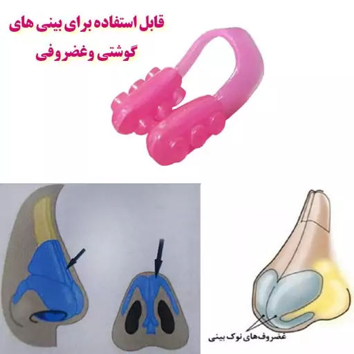 گیره کوچک کننده بینی نوز آپ 