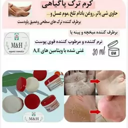 کرم ترک پا گیاهی