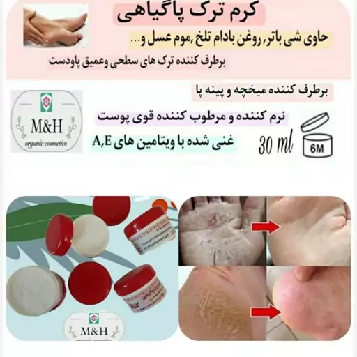 کرم ترک پا گیاهی