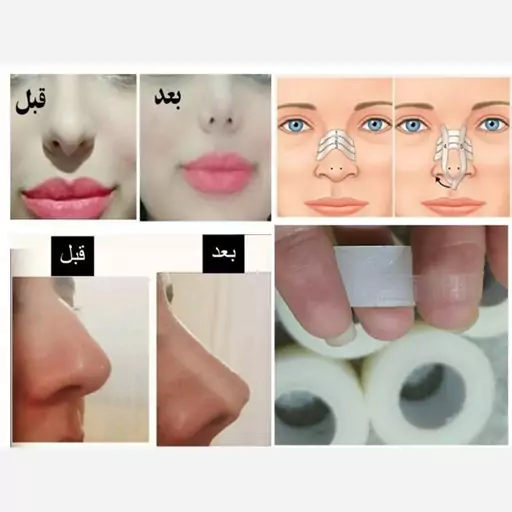 چسب لیفت بینی کوچک کننده لیفت کننده 