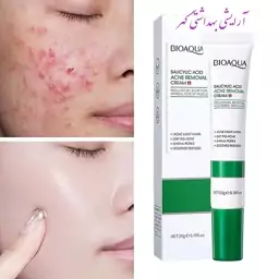 کرم تخصصی ضد جوش و آکنه سالیسیلیک اسید بیوآکوا (BIOAQUA) حجم 20 گرم