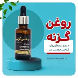 روغن گزنه 60 میلی لیتر