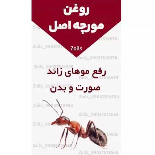 روغن مورچه یک لیتری (رفع موهای زائد صورت و بدن)رفع موهای زاید روغن موبر نوره موی زائد