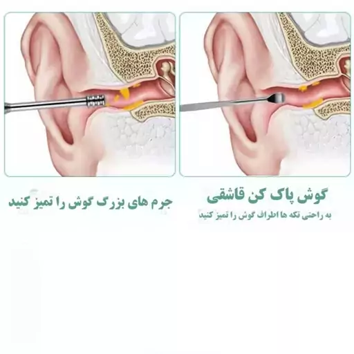 مجموعه نظافت گوش مدل M1 بسته 6 عددی