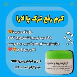 کرم ترک پا یارا رفع پینه های قوزک زانو و آرنج 