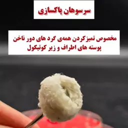 سر سوهان پاکسازی