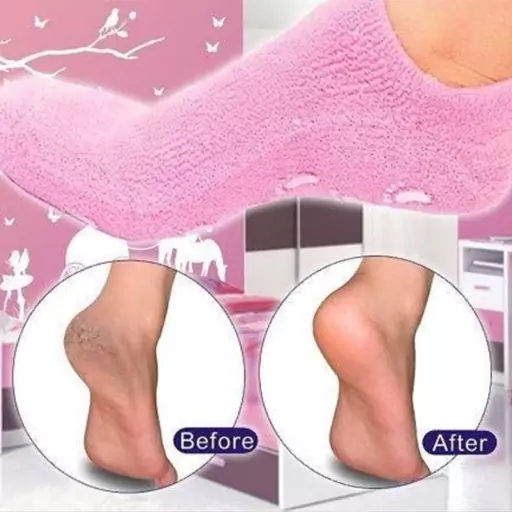 جوراب سیلیکونی رفع ترک پا MOISTURISING SPA GEL SOCKS