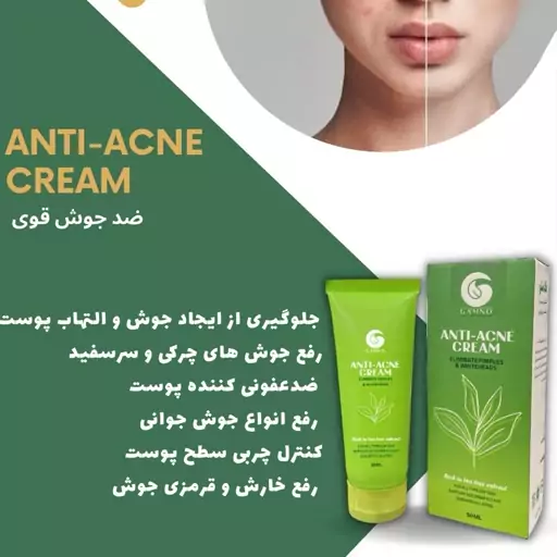 کرم ضدجوش قوی گامنو آنتی آکنه Anti acne 