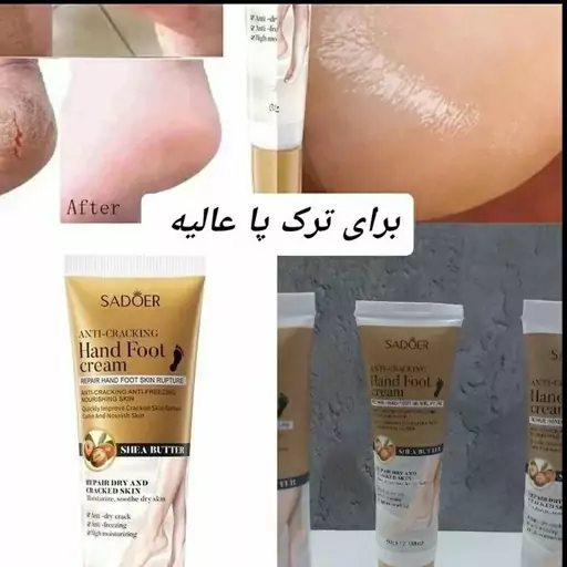 کرم ترک پا