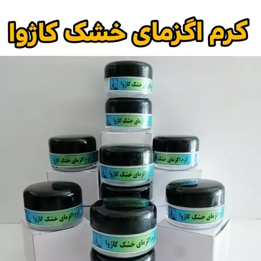 کرم اگزما رفع پوسته پوست شدن و ضد خارش و التهاب پوست کرم اگزما کاژوا