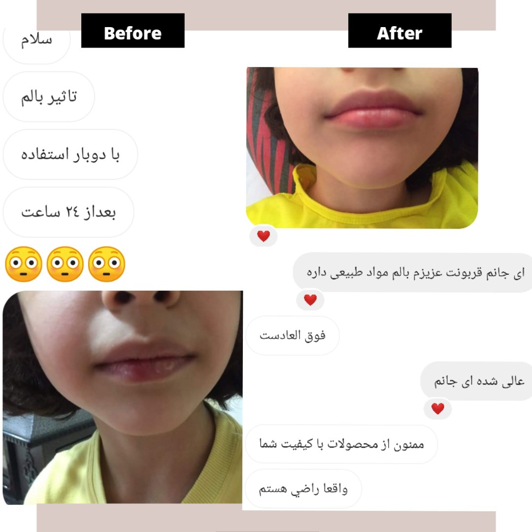 بالم لب طبیعی در چهار طعم متفاوت حاوی کره کاکائو و روغن بادام شیرین