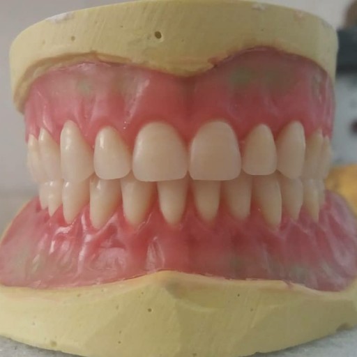  آموزش دندانسازی ساخت دندان مصنوعی