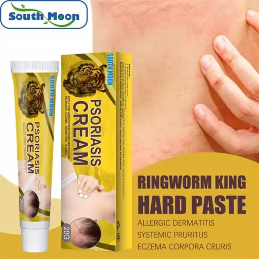 کرم ضدجوش بدن (درمانی) South moon psoriasis cream کرم ضدجوش بدن (درمانی) اورجینال