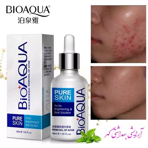 سرم اورجینال ضد جوش و آکنه بیوآکوا (BIOAQUA) حجم 30 میل