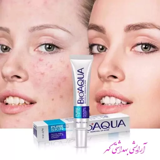 کرم ضد جوش اورجینال بیوآکوا (BIOAQUA) حجم 30 گرم