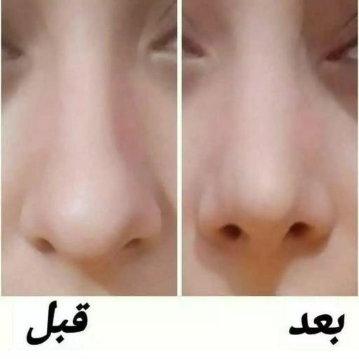 چسب لیفت صورت وبینی